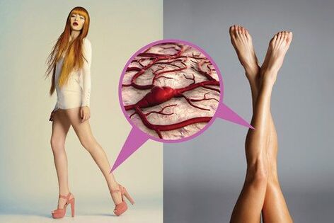 Different veins