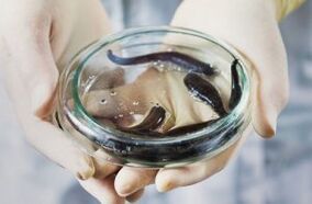 Treatment of varicose veins with leeches