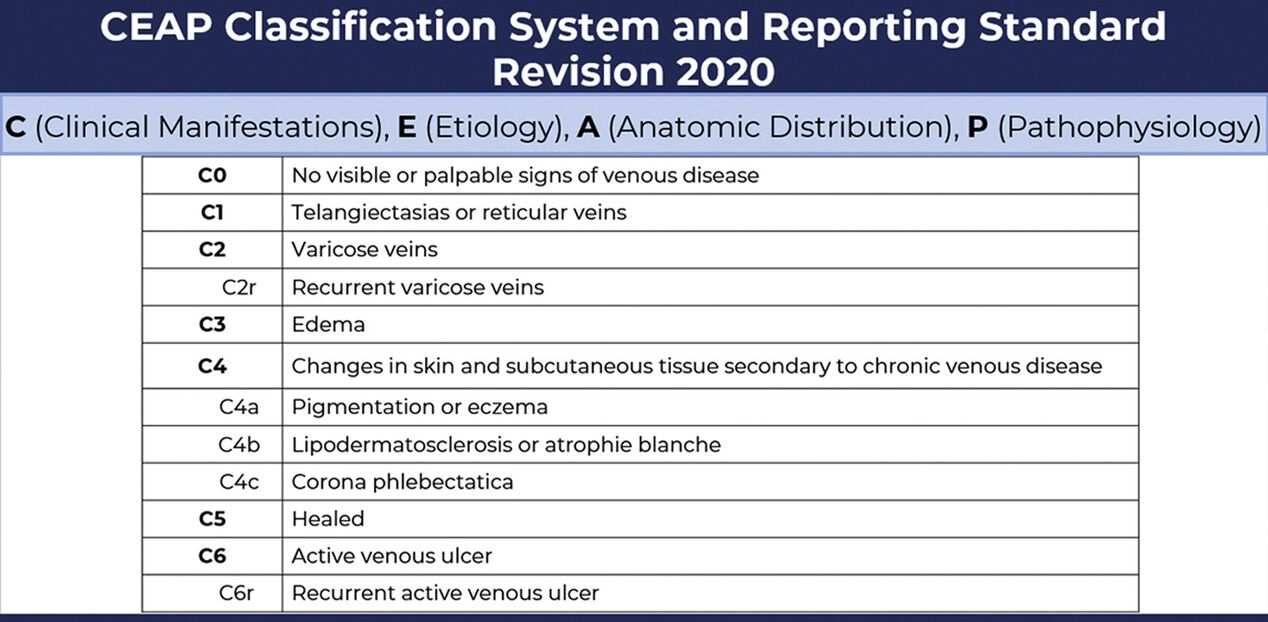 Stages of varicose veins according to the CEAP classification, revised in 2020